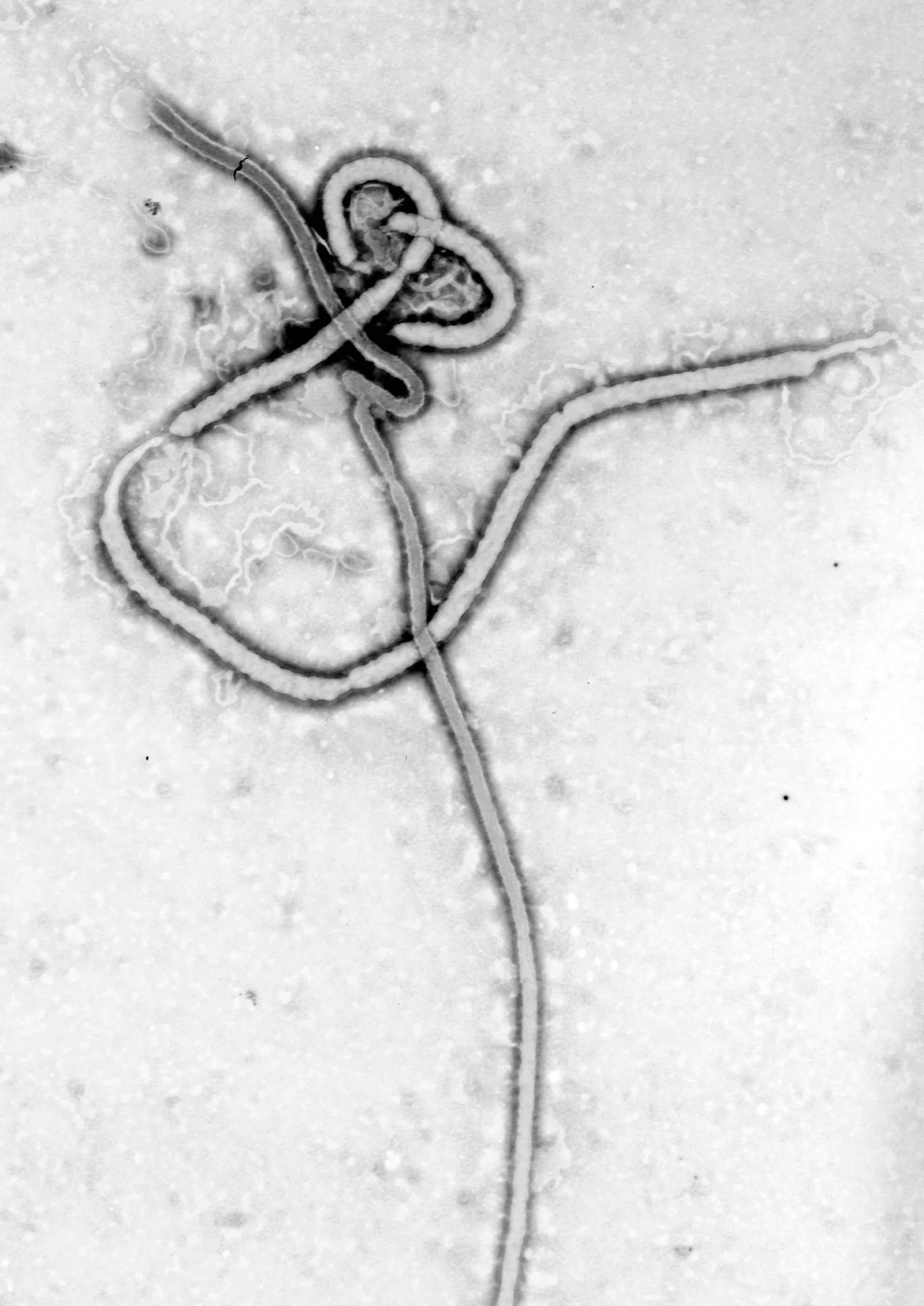 Elektronenmikroskopische Aufnahme des Ebola-Virus